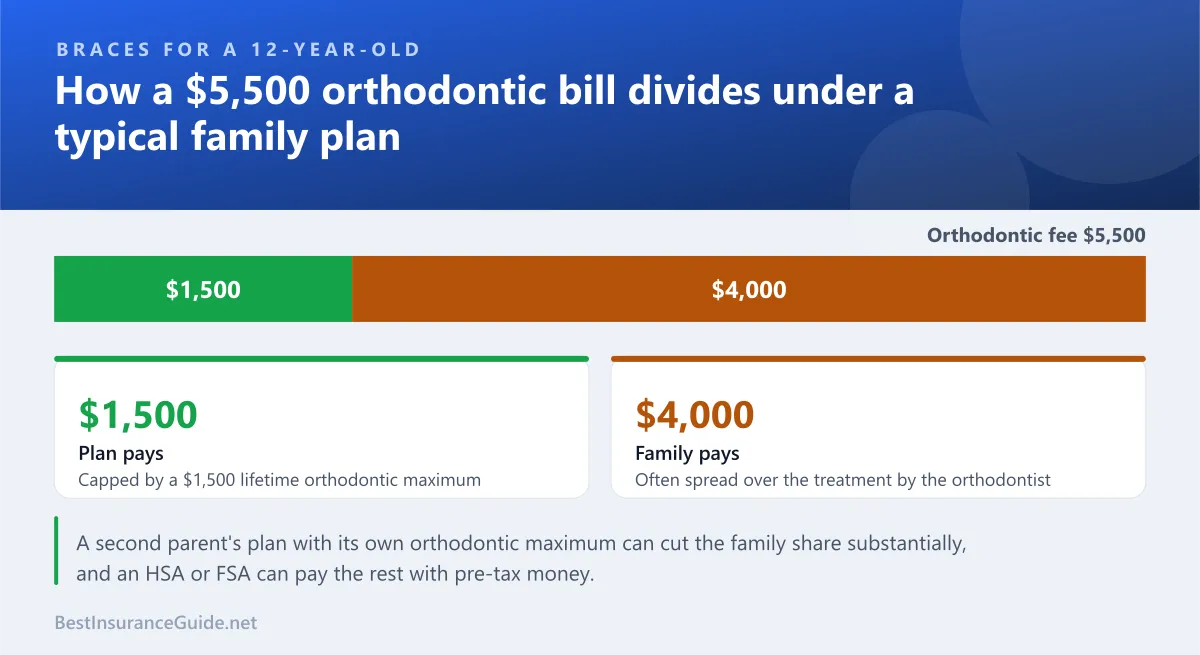 Split chart showing how the cost of orthodontic treatment is divided between the plan and the family