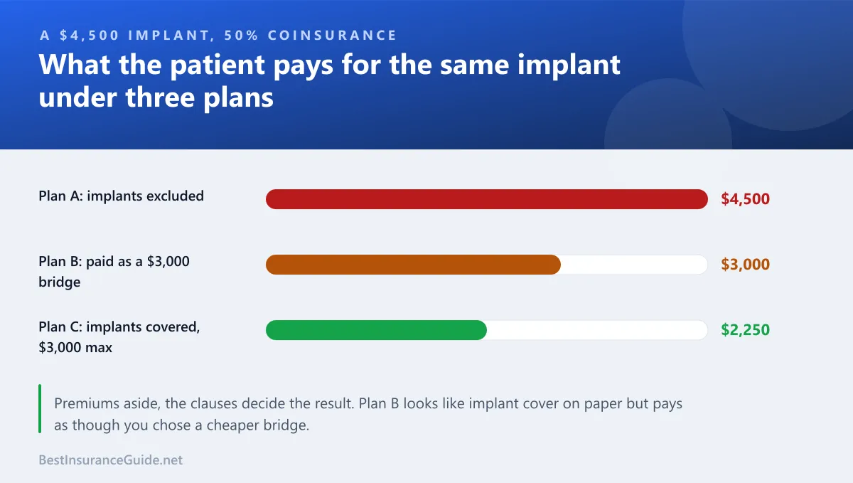 Bar chart comparing what a patient pays for the same implant under three different dental plans