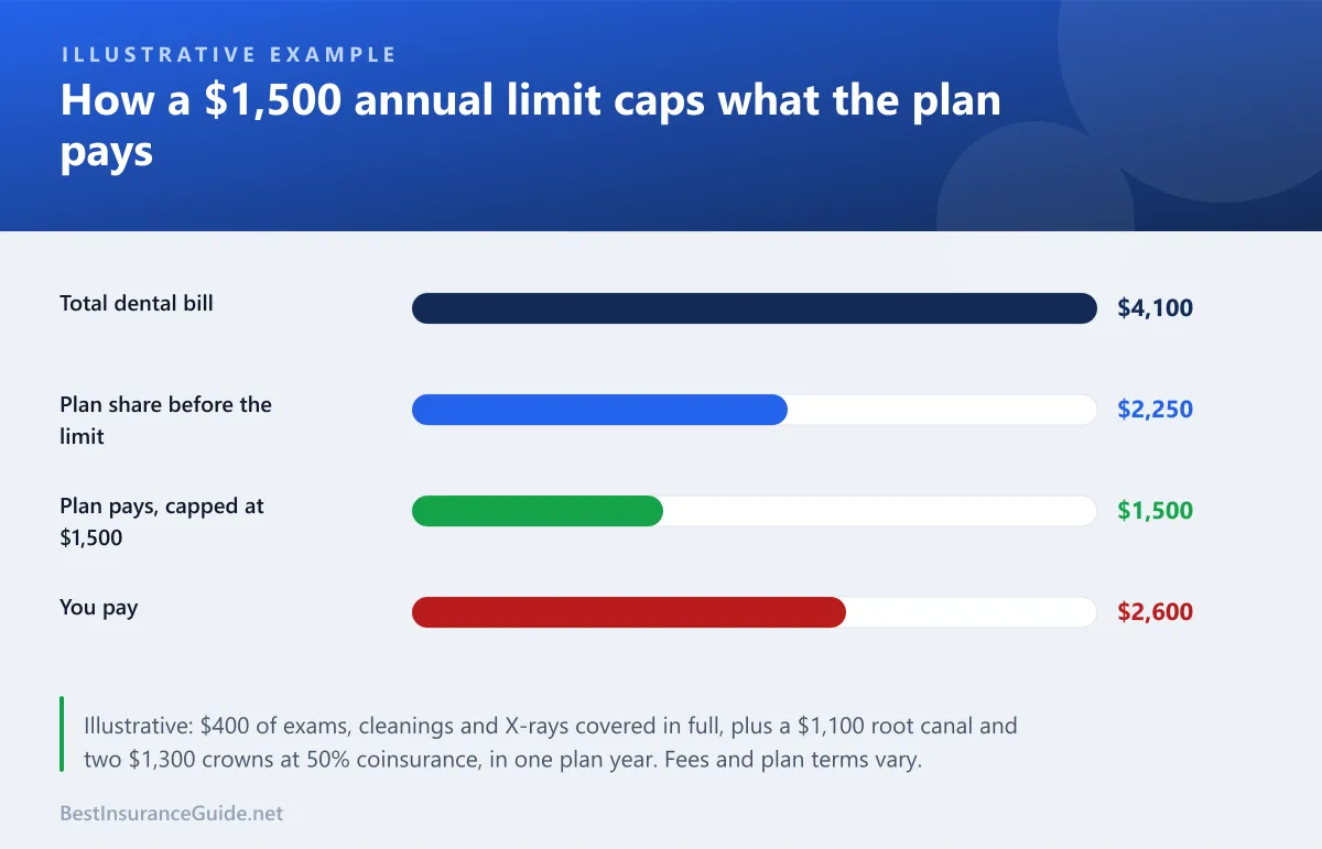 Bar chart of an illustrative dental bill of $4,100, where the plan's share before the annual limit would be $2,250 but a $1,500 annual maximum means the plan pays $1,500 and the member pays $2,600