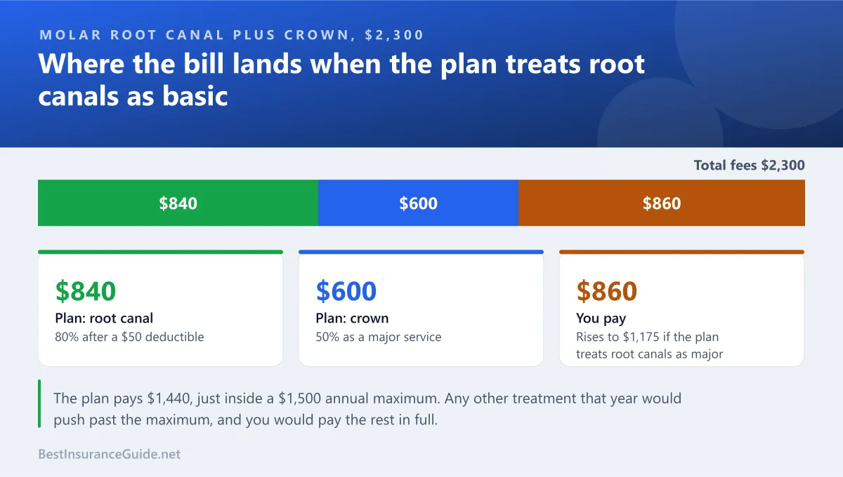 Split chart showing how a root canal and crown bill is divided between the insurer and the patient