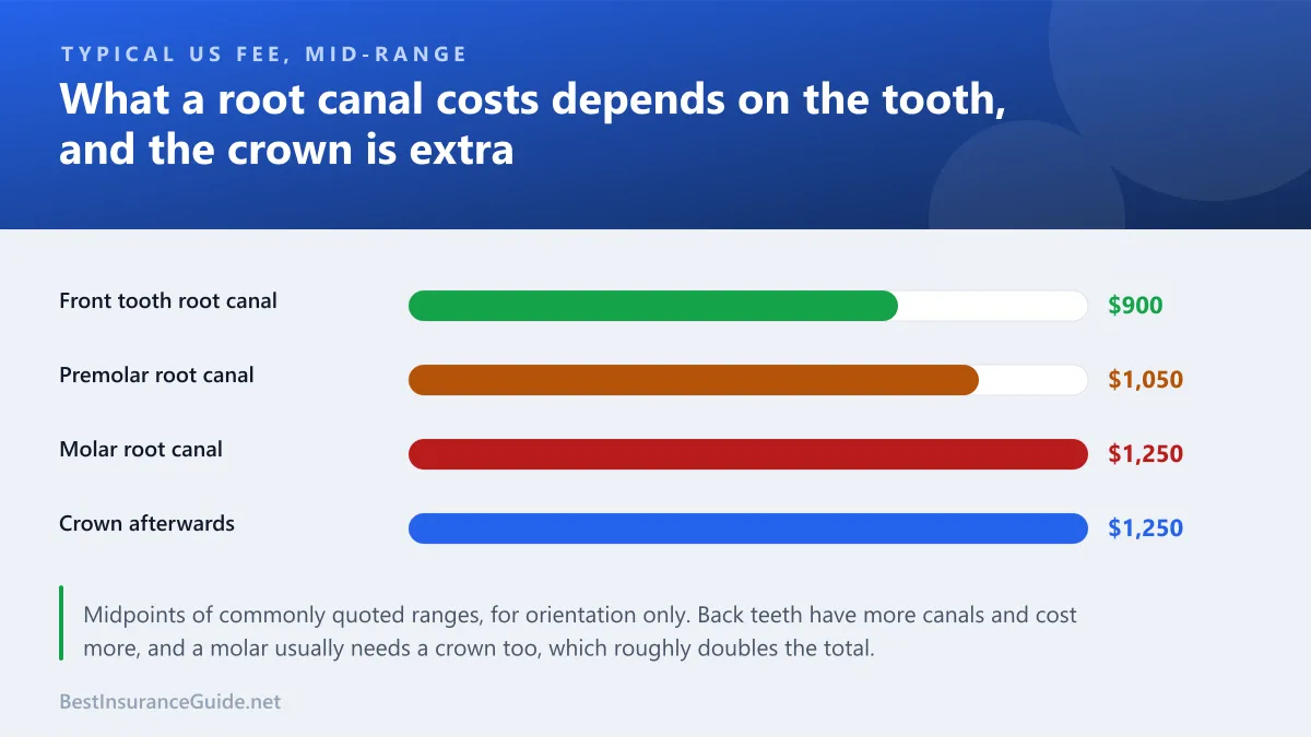 Bar chart comparing typical fees for a root canal on a front tooth, a premolar and a molar, and for the crown afterwards